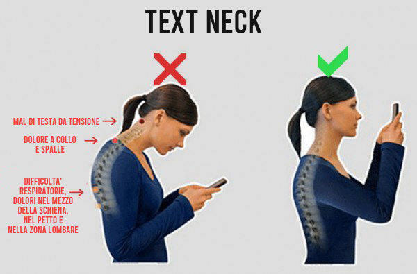 Sintomi Text Neck